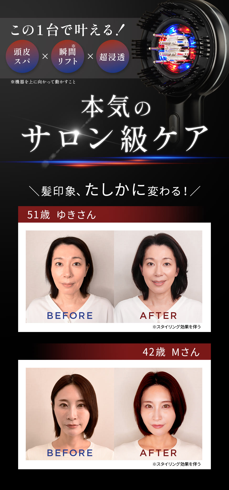 BEFORE＆AFTER